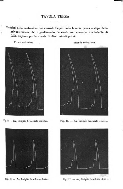 Il morgagni giornale indirizzato al progresso della medicina. Parte 1., Archivio o Memorie originali