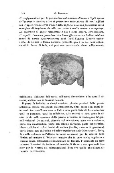 Il morgagni giornale indirizzato al progresso della medicina. Parte 1., Archivio o Memorie originali