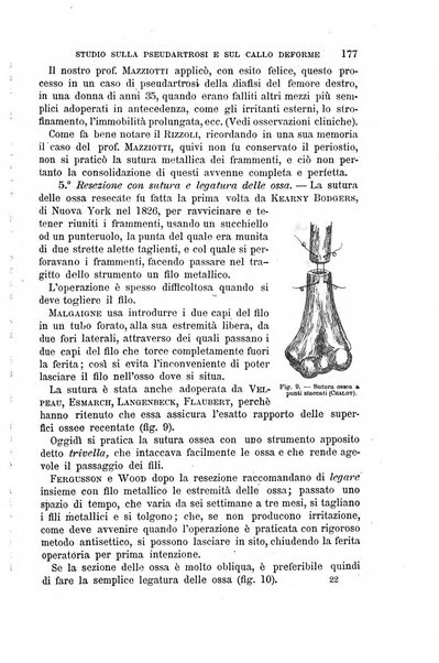 Il morgagni giornale indirizzato al progresso della medicina. Parte 1., Archivio o Memorie originali