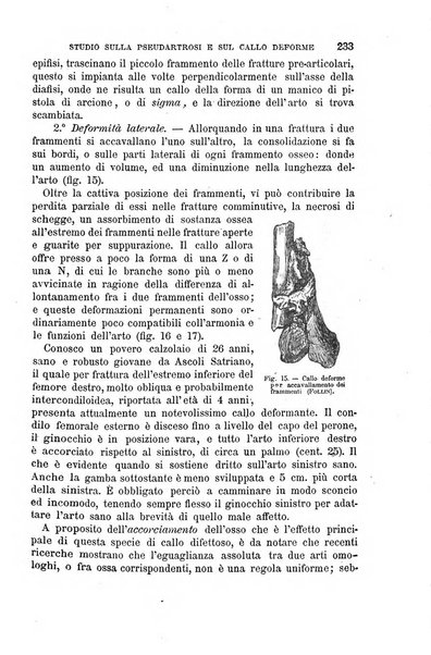 Il morgagni giornale indirizzato al progresso della medicina. Parte 1., Archivio o Memorie originali