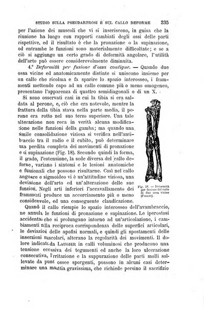 Il morgagni giornale indirizzato al progresso della medicina. Parte 1., Archivio o Memorie originali