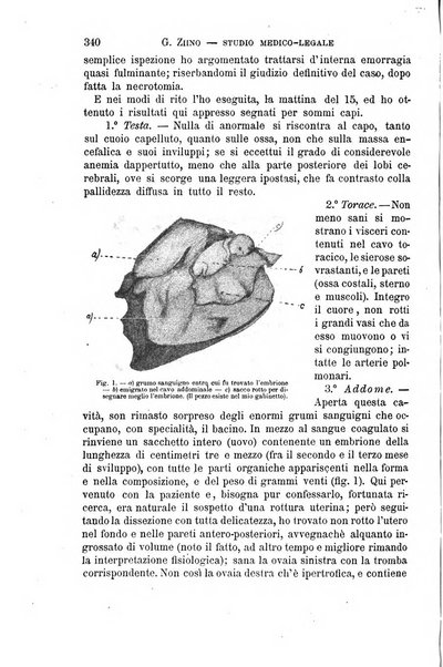 Il morgagni giornale indirizzato al progresso della medicina. Parte 1., Archivio o Memorie originali