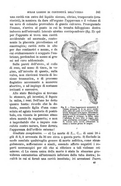 Il morgagni giornale indirizzato al progresso della medicina. Parte 1., Archivio o Memorie originali