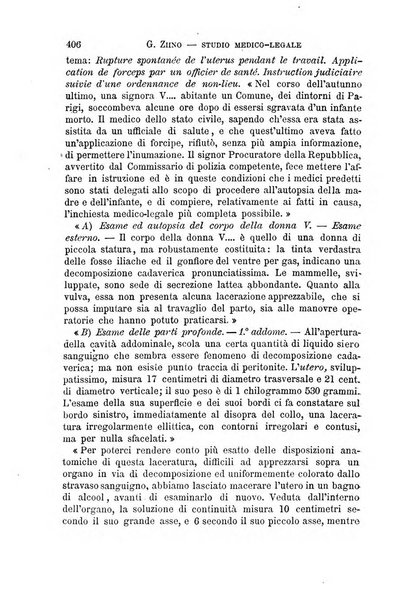 Il morgagni giornale indirizzato al progresso della medicina. Parte 1., Archivio o Memorie originali