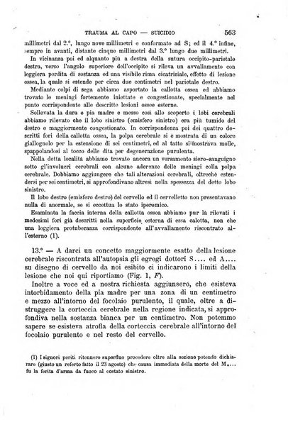 Il morgagni giornale indirizzato al progresso della medicina. Parte 1., Archivio o Memorie originali