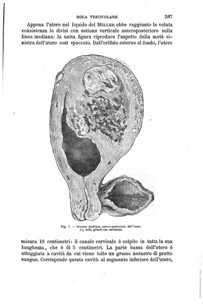 Il morgagni giornale indirizzato al progresso della medicina. Parte 1., Archivio o Memorie originali