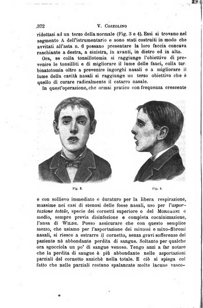 Il morgagni giornale indirizzato al progresso della medicina. Parte 1., Archivio o Memorie originali