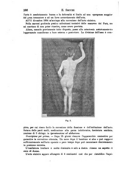 Il morgagni giornale indirizzato al progresso della medicina. Parte 1., Archivio o Memorie originali