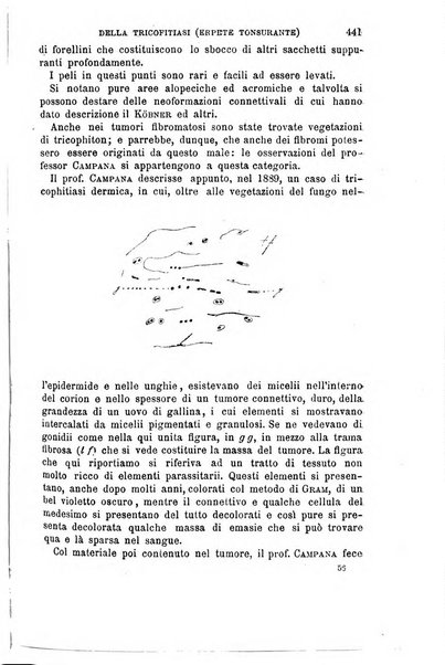 Il morgagni giornale indirizzato al progresso della medicina. Parte 1., Archivio o Memorie originali