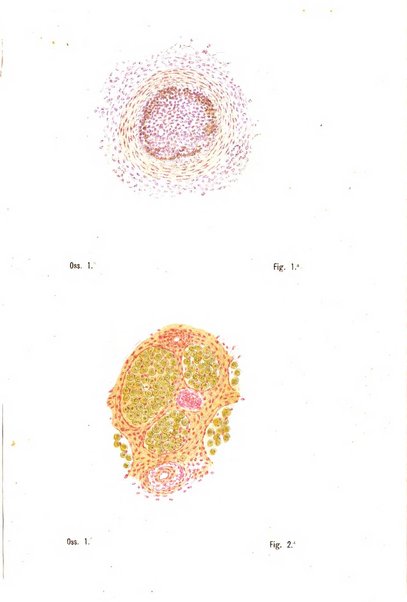 Il morgagni giornale indirizzato al progresso della medicina. Parte 1., Archivio o Memorie originali