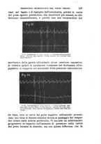 giornale/NAP0034716/1896/unico/00000185