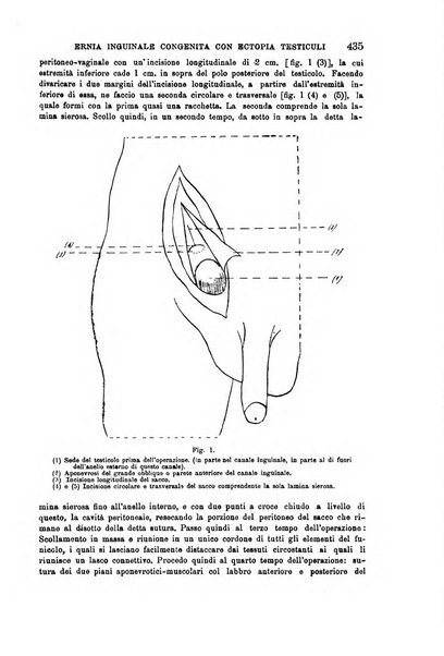 Il morgagni giornale indirizzato al progresso della medicina. Parte 1., Archivio o Memorie originali