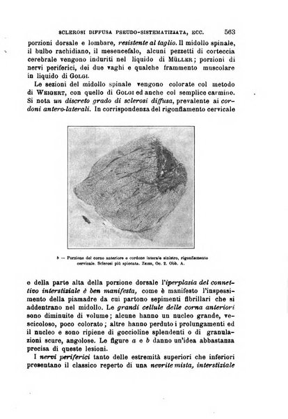 Il morgagni giornale indirizzato al progresso della medicina. Parte 1., Archivio o Memorie originali