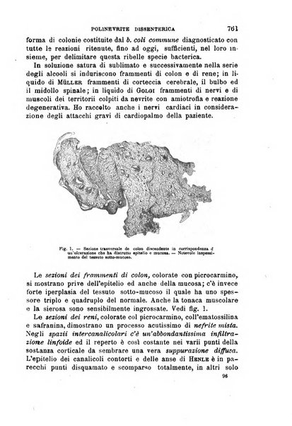 Il morgagni giornale indirizzato al progresso della medicina. Parte 1., Archivio o Memorie originali