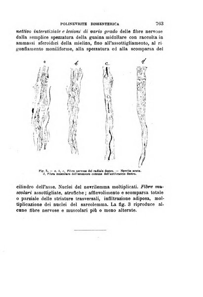 Il morgagni giornale indirizzato al progresso della medicina. Parte 1., Archivio o Memorie originali