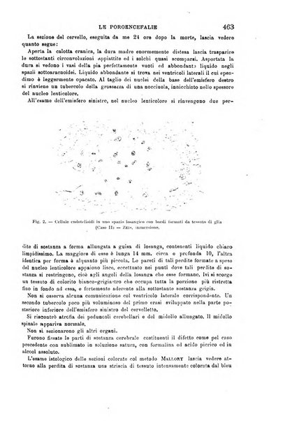 Il morgagni giornale indirizzato al progresso della medicina. Parte 1., Archivio o Memorie originali