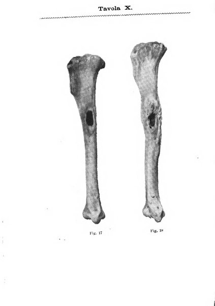 Il morgagni giornale indirizzato al progresso della medicina. Parte 1., Archivio o Memorie originali