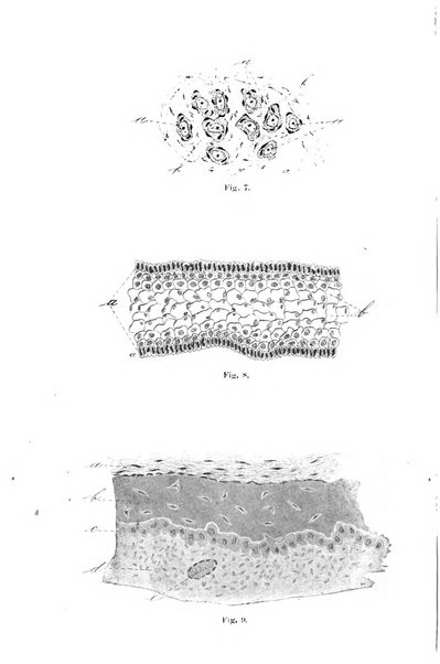 Il morgagni giornale indirizzato al progresso della medicina. Parte 1., Archivio o Memorie originali