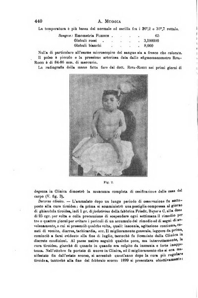 Il morgagni giornale indirizzato al progresso della medicina. Parte 1., Archivio o Memorie originali