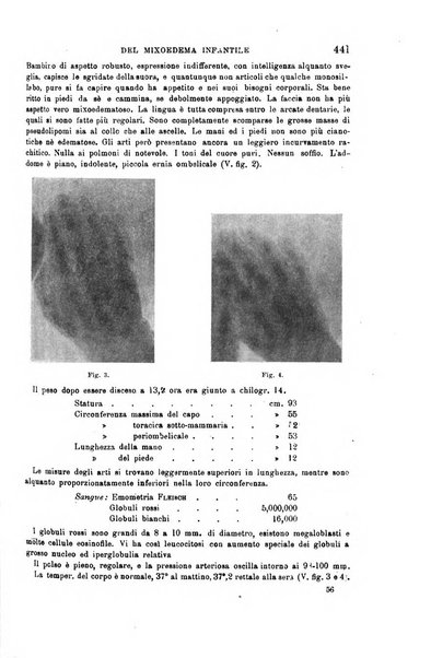 Il morgagni giornale indirizzato al progresso della medicina. Parte 1., Archivio o Memorie originali