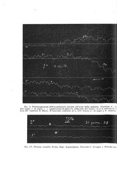 Il morgagni giornale indirizzato al progresso della medicina. Parte 1., Archivio o Memorie originali