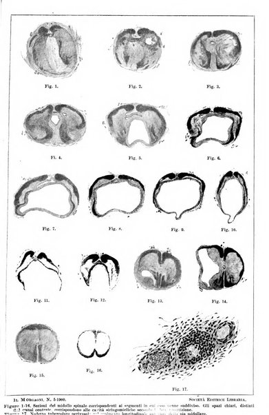 Il morgagni giornale indirizzato al progresso della medicina. Parte 1., Archivio o Memorie originali