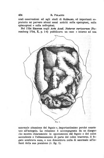 Il morgagni giornale indirizzato al progresso della medicina. Parte 1., Archivio o Memorie originali