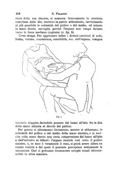 Il morgagni giornale indirizzato al progresso della medicina. Parte 1., Archivio o Memorie originali