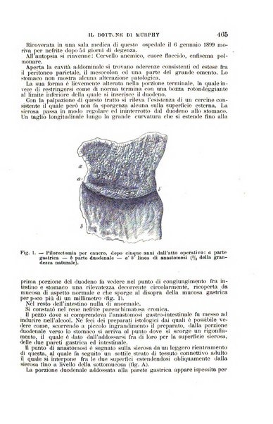 Il morgagni giornale indirizzato al progresso della medicina. Parte 1., Archivio o Memorie originali