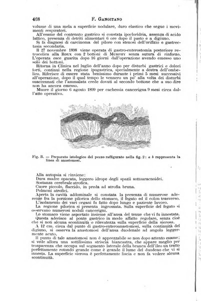 Il morgagni giornale indirizzato al progresso della medicina. Parte 1., Archivio o Memorie originali