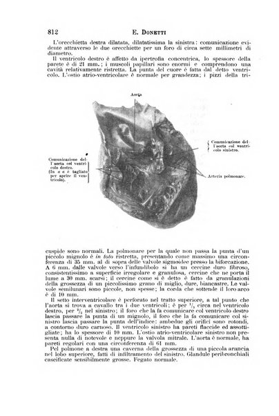 Il morgagni giornale indirizzato al progresso della medicina. Parte 1., Archivio o Memorie originali