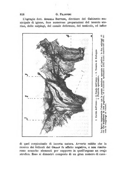 Il morgagni giornale indirizzato al progresso della medicina. Parte 1., Archivio o Memorie originali