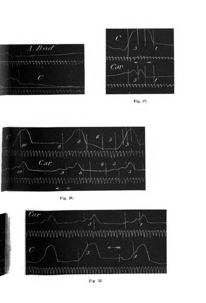 Il morgagni giornale indirizzato al progresso della medicina. Parte 1., Archivio o Memorie originali