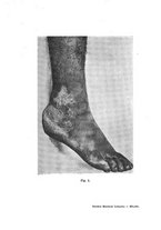 giornale/NAP0034716/1903/unico/00000019