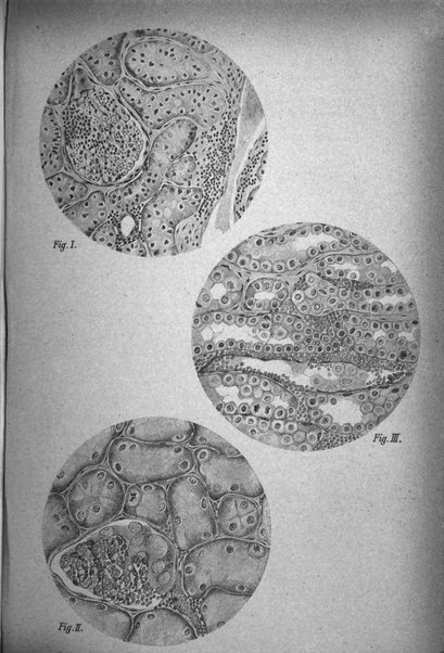 Il morgagni giornale indirizzato al progresso della medicina. Parte 1., Archivio o Memorie originali