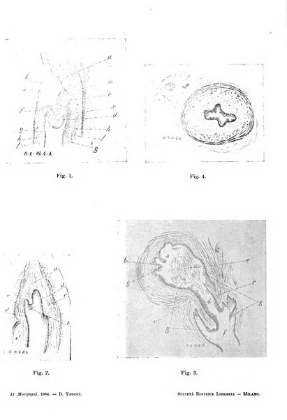 Il morgagni giornale indirizzato al progresso della medicina. Parte 1., Archivio o Memorie originali