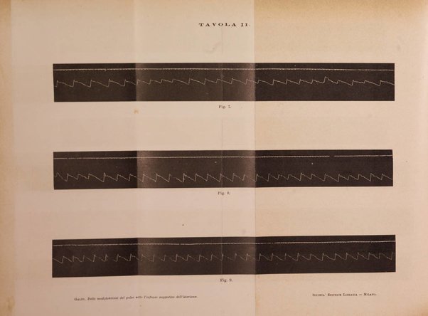 Il morgagni giornale indirizzato al progresso della medicina. Parte 1., Archivio o Memorie originali