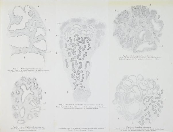 Il morgagni giornale indirizzato al progresso della medicina. Parte 1., Archivio o Memorie originali