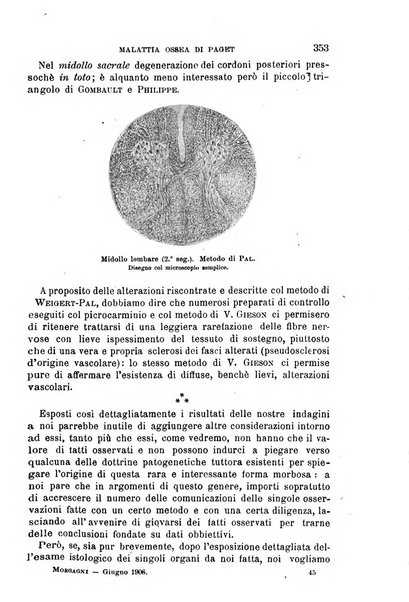 Il morgagni giornale indirizzato al progresso della medicina. Parte 1., Archivio o Memorie originali