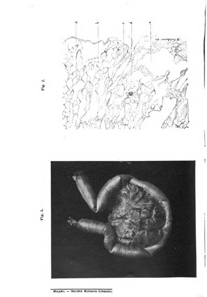 Il morgagni giornale indirizzato al progresso della medicina. Parte 1., Archivio o Memorie originali