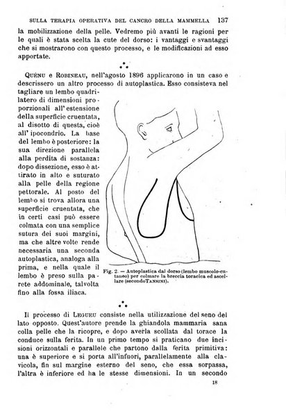 Il morgagni giornale indirizzato al progresso della medicina. Parte 1., Archivio o Memorie originali