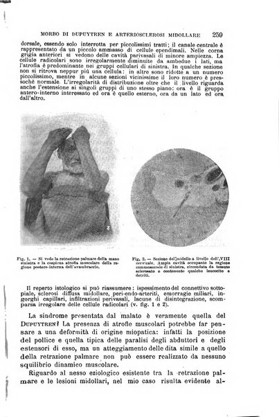 Il morgagni giornale indirizzato al progresso della medicina. Parte 1., Archivio o Memorie originali