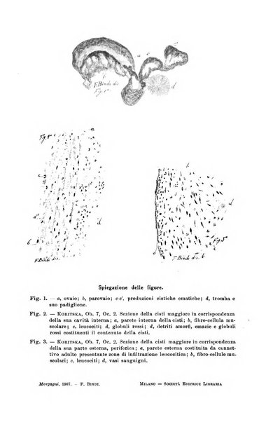 Il morgagni giornale indirizzato al progresso della medicina. Parte 1., Archivio o Memorie originali