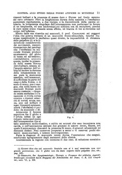 Il morgagni giornale indirizzato al progresso della medicina. Parte 1., Archivio o Memorie originali