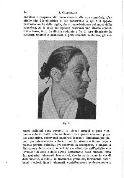 Il morgagni giornale indirizzato al progresso della medicina. Parte 1., Archivio o Memorie originali