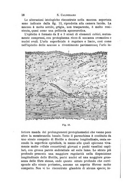 Il morgagni giornale indirizzato al progresso della medicina. Parte 1., Archivio o Memorie originali