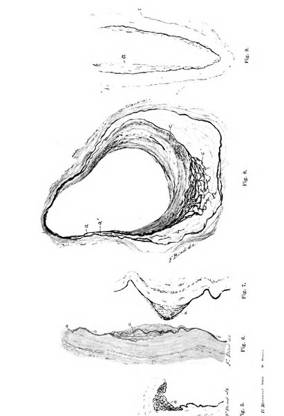 Il morgagni giornale indirizzato al progresso della medicina. Parte 1., Archivio o Memorie originali