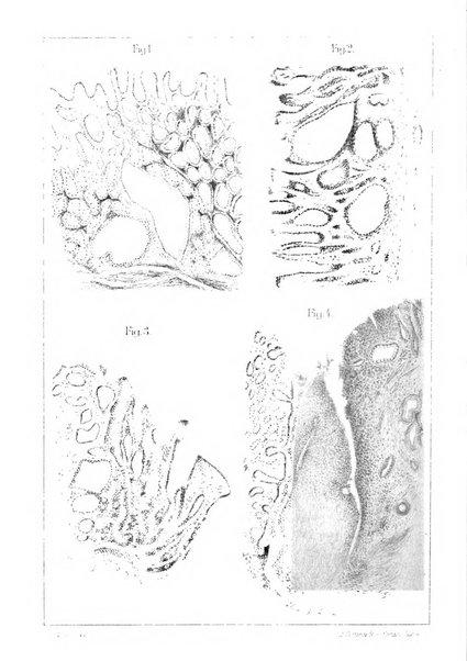 Il morgagni giornale indirizzato al progresso della medicina. Parte 1., Archivio o Memorie originali