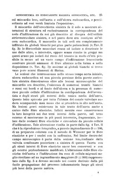 Il morgagni giornale indirizzato al progresso della medicina. Parte 1., Archivio o Memorie originali