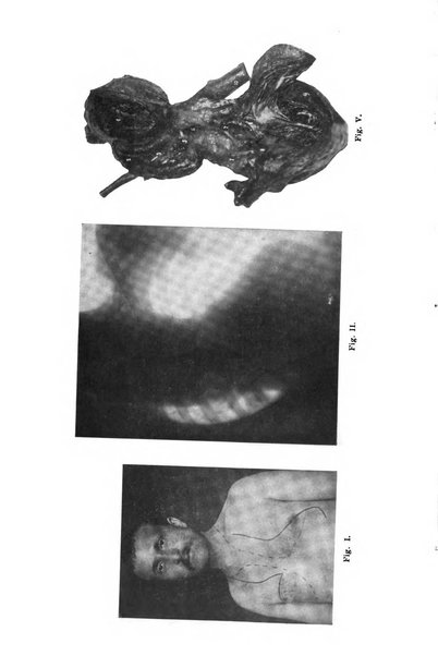 Il morgagni giornale indirizzato al progresso della medicina. Parte 1., Archivio o Memorie originali